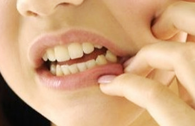 突發(fā)性、自發(fā)性的劇烈牙疼