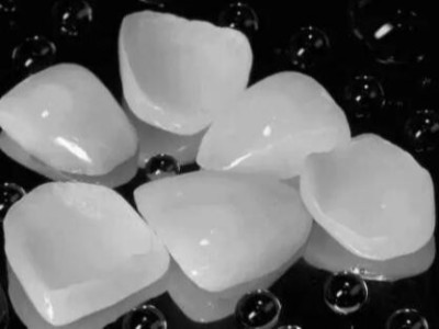 承德口腔解答：補(bǔ)牙的時候為什么要磨牙?