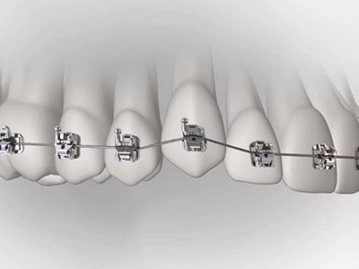 承德市哪家口腔醫(yī)院口腔正畸做得好？惟德口腔醫(yī)院來告訴您