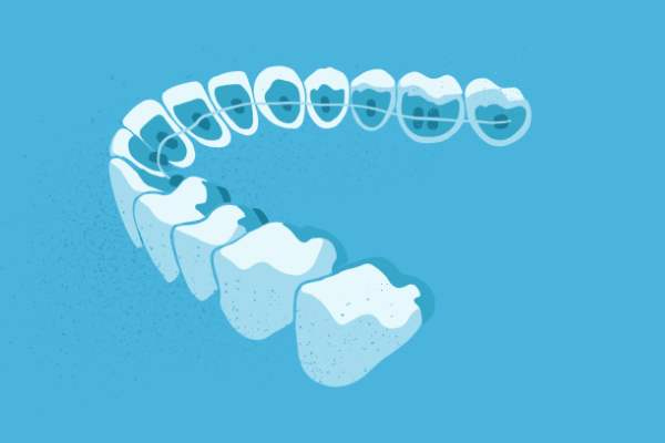 惟德口腔醫(yī)院口腔正畸好不好？